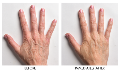 Instant Hand Perfector